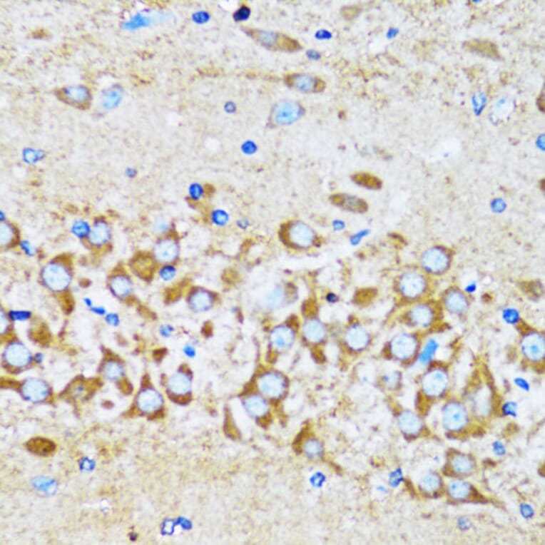 Immunohistochemistry - Anti-Arp2 Antibody (A14940) - Antibodies.com