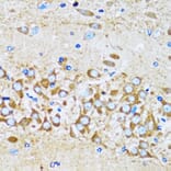 Immunohistochemistry - Anti-Arp2 Antibody (A14940) - Antibodies.com