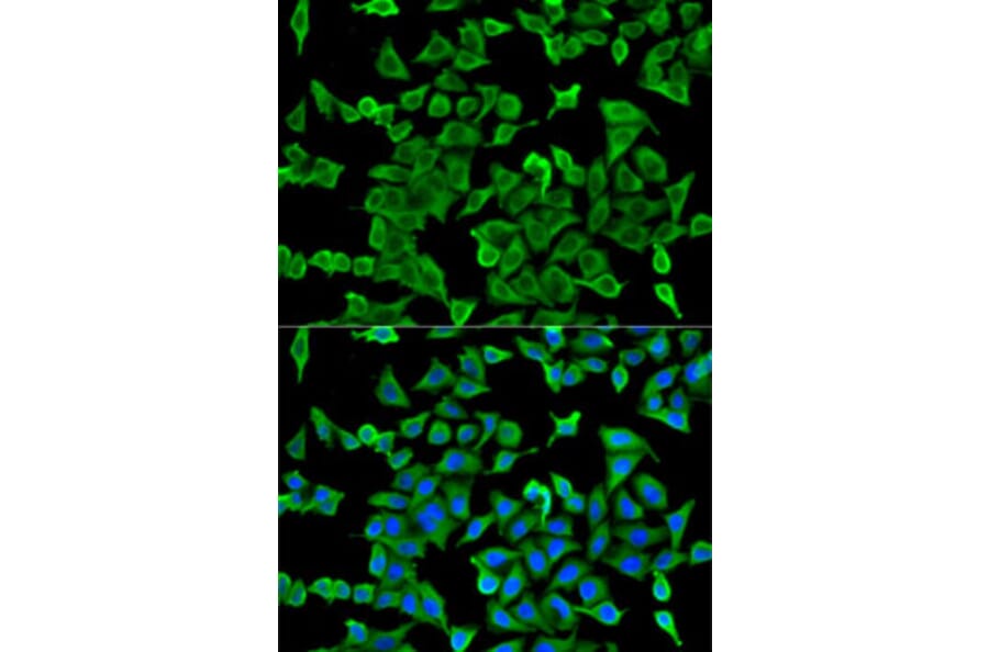 Immunofluorescence - Anti-Arp2 Antibody (A14940) - Antibodies.com