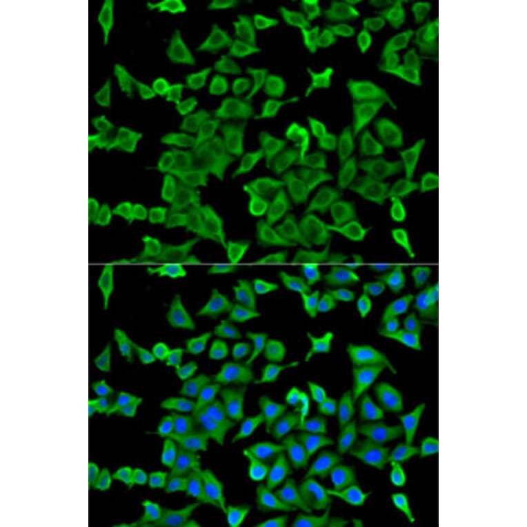Immunofluorescence - Anti-Arp2 Antibody (A14940) - Antibodies.com