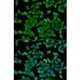 Immunofluorescence - Anti-Arp2 Antibody (A14940) - Antibodies.com