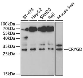 Western Blot - Anti-CRYGD Antibody (A14941) - Antibodies.com