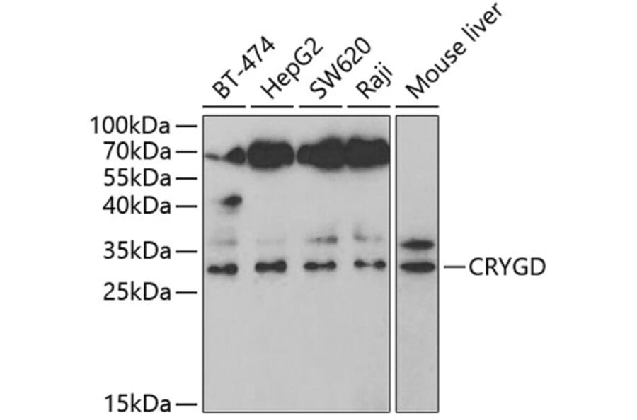 Western Blot - Anti-CRYGD Antibody (A14941) - Antibodies.com