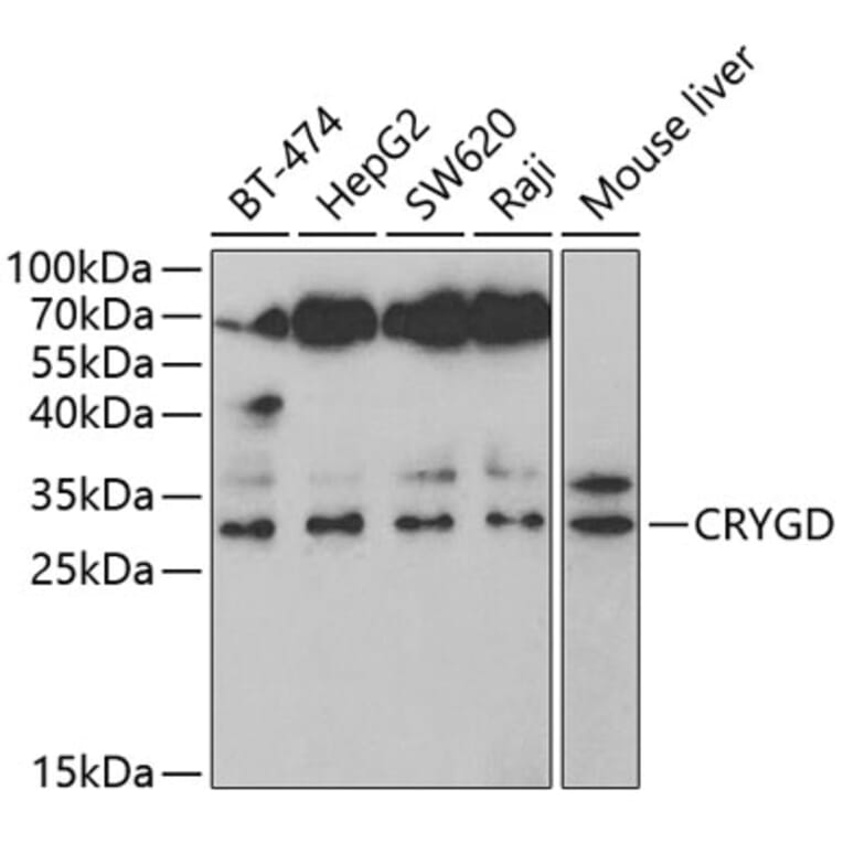 Western Blot - Anti-CRYGD Antibody (A14941) - Antibodies.com