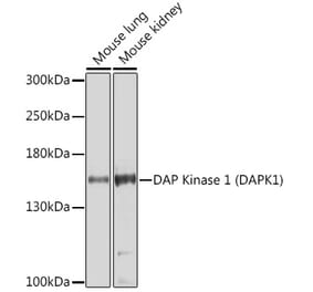 Western Blot - Anti-DAP Kinase 1 Antibody (A14942) - Antibodies.com