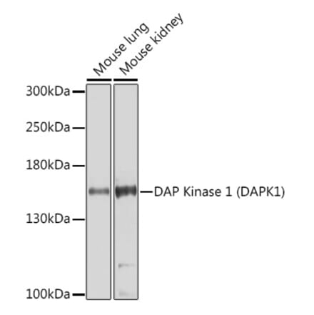 Western Blot - Anti-DAP Kinase 1 Antibody (A14942) - Antibodies.com