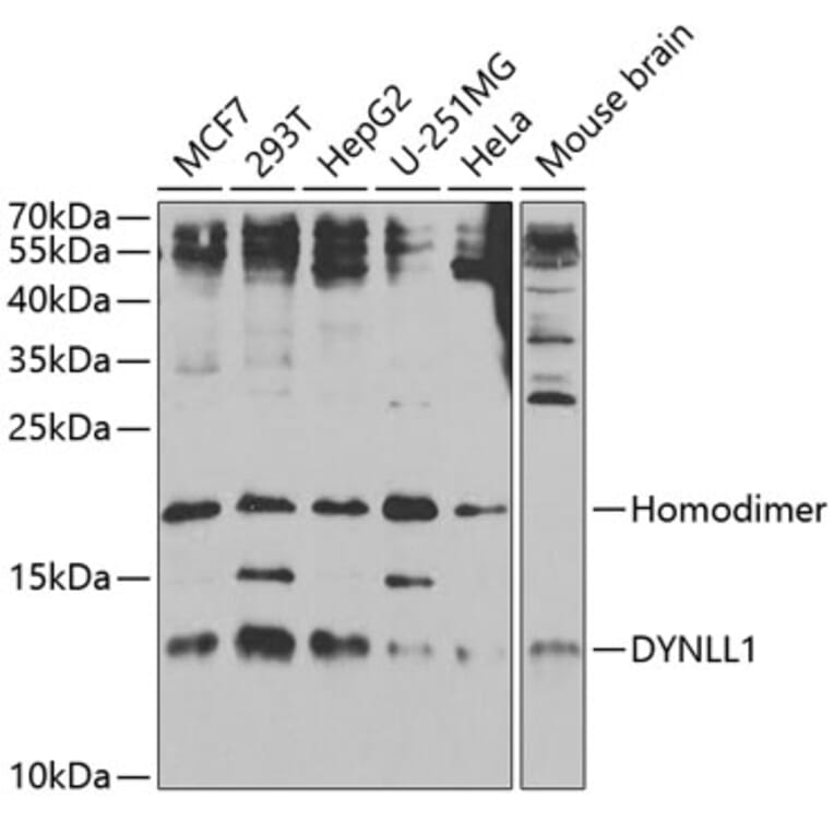 Western Blot - Anti-DYNLL1/PIN Antibody (A14943) - Antibodies.com