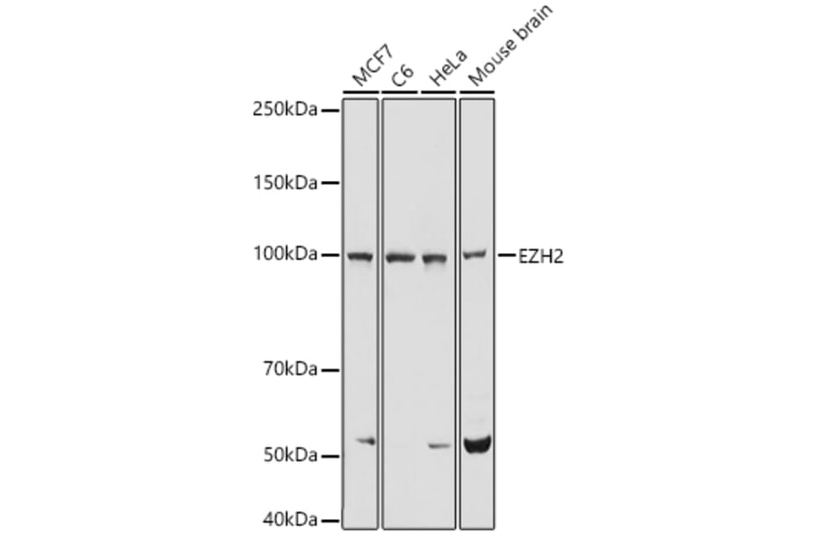 Western Blot - Anti-EZH2 Antibody (A14944) - Antibodies.com