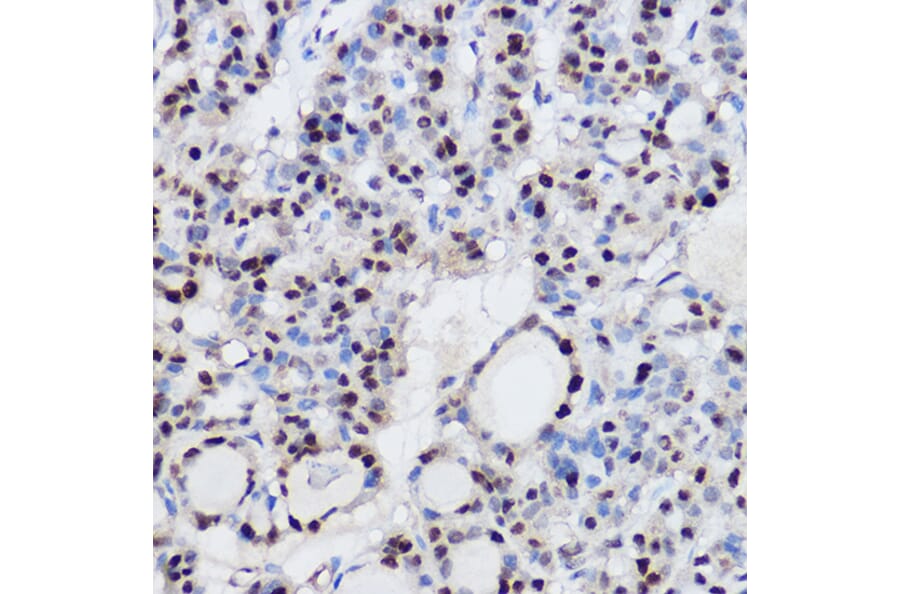 Immunohistochemistry - Anti-EZH2 Antibody (A14944) - Antibodies.com