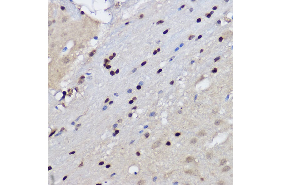 Immunohistochemistry - Anti-EZH2 Antibody (A14944) - Antibodies.com