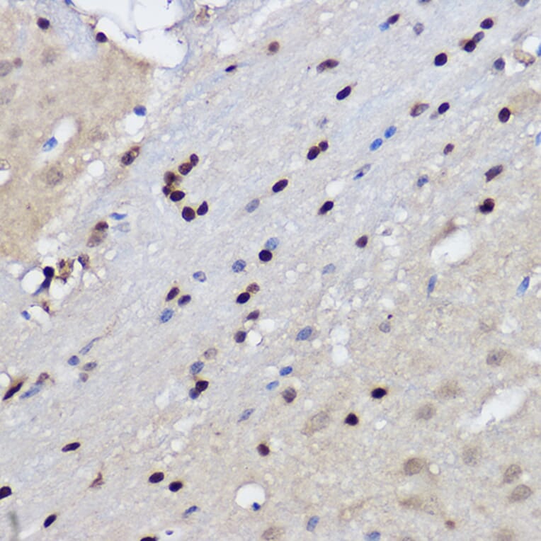 Immunohistochemistry - Anti-EZH2 Antibody (A14944) - Antibodies.com