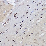 Immunohistochemistry - Anti-EZH2 Antibody (A14944) - Antibodies.com