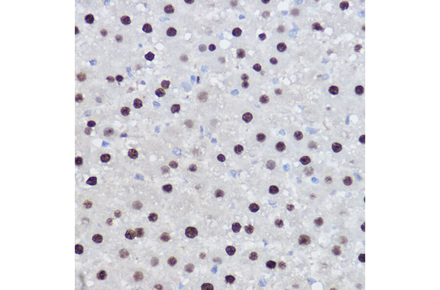 Immunohistochemistry - Anti-EZH2 Antibody (A14944) - Antibodies.com