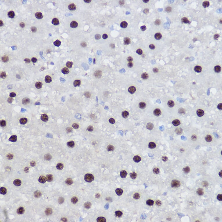 Immunohistochemistry - Anti-EZH2 Antibody (A14944) - Antibodies.com