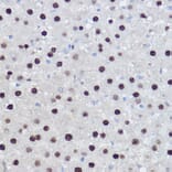 Immunohistochemistry - Anti-EZH2 Antibody (A14944) - Antibodies.com