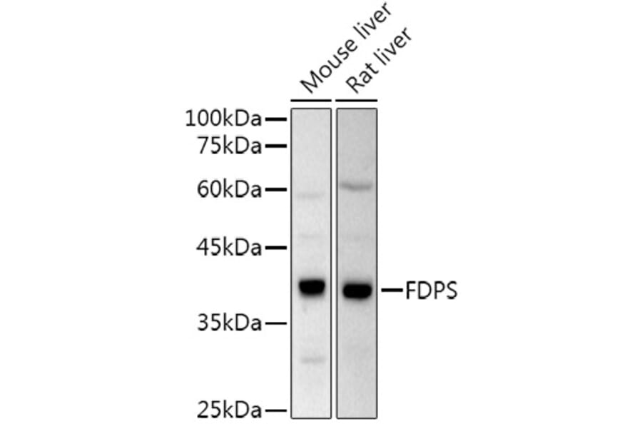 Western Blot - Anti-FDPS/FPS Antibody (A14945) - Antibodies.com