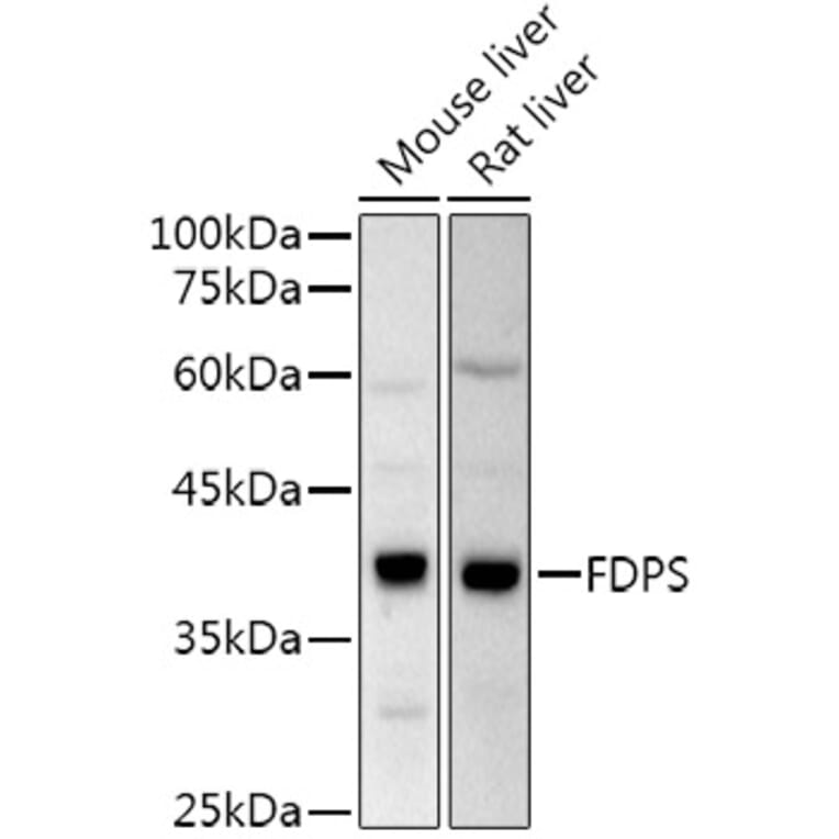 Western Blot - Anti-FDPS/FPS Antibody (A14945) - Antibodies.com