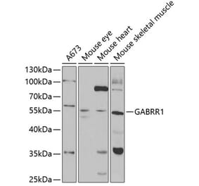 Western Blot - Anti-GABRR1 Antibody (A14946) - Antibodies.com