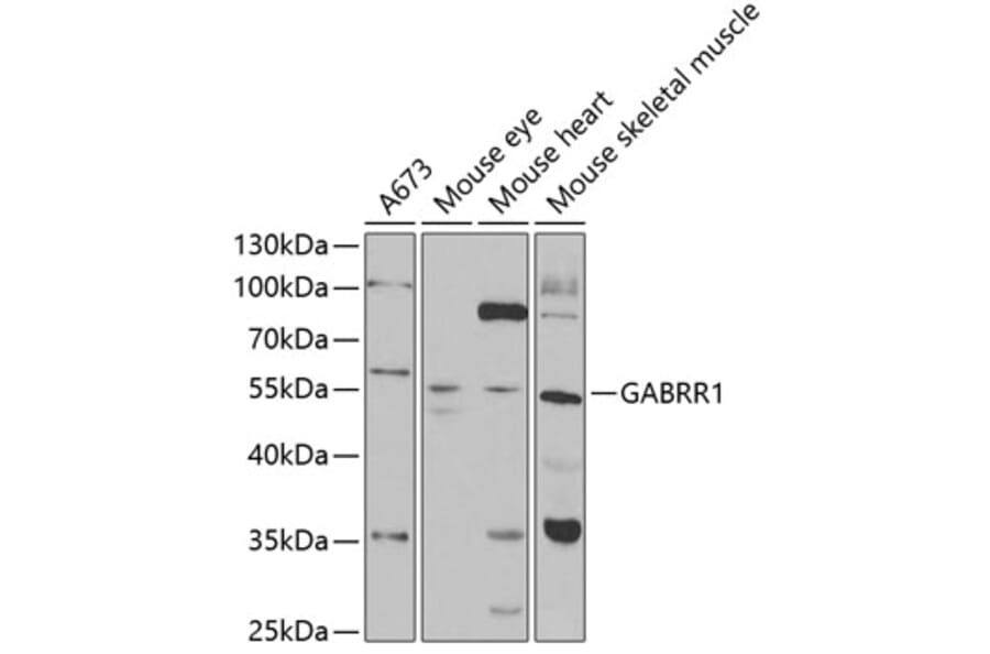 Western Blot - Anti-GABRR1 Antibody (A14946) - Antibodies.com