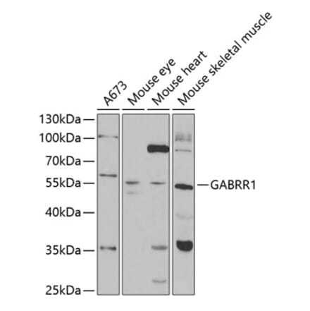 Western Blot - Anti-GABRR1 Antibody (A14946) - Antibodies.com