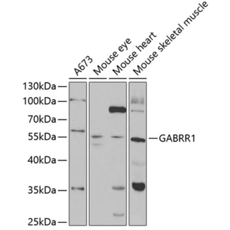 Western Blot - Anti-GABRR1 Antibody (A14946) - Antibodies.com