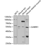 Western Blot - Anti-GABRR1 Antibody (A14946) - Antibodies.com