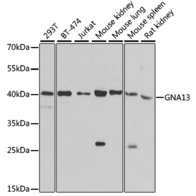 Western Blot - Anti-GNA13 Antibody (A5746) - Antibodies.com