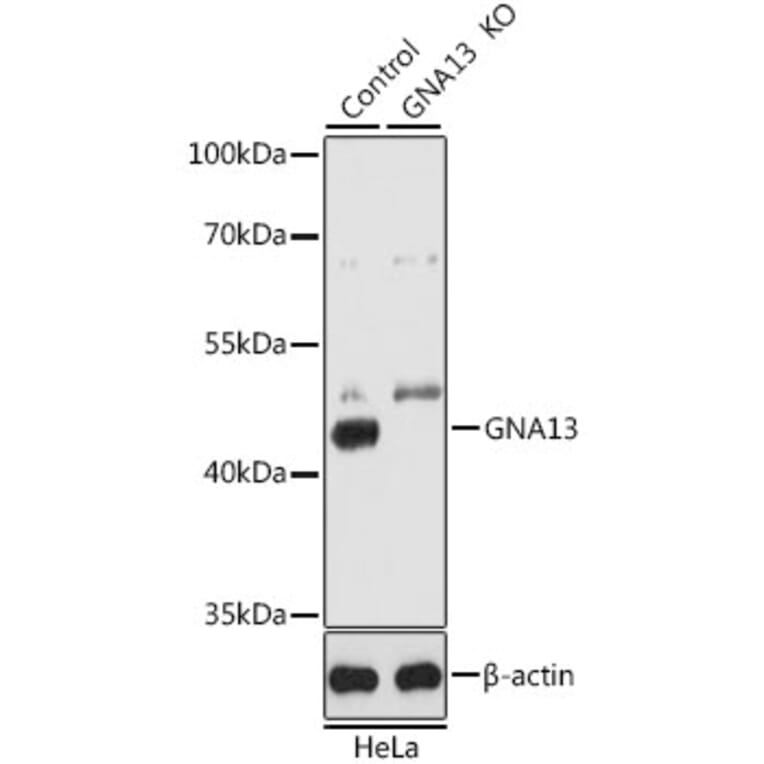 Western Blot - Anti-GNA13 Antibody (A5746) - Antibodies.com