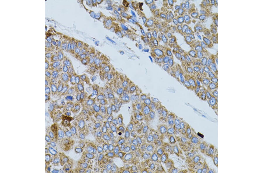 Immunohistochemistry - Anti-GNA13 Antibody (A5746) - Antibodies.com