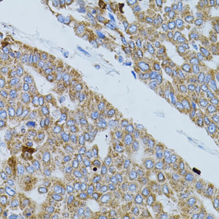 Immunohistochemistry - Anti-GNA13 Antibody (A5746) - Antibodies.com