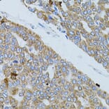 Immunohistochemistry - Anti-GNA13 Antibody (A5746) - Antibodies.com