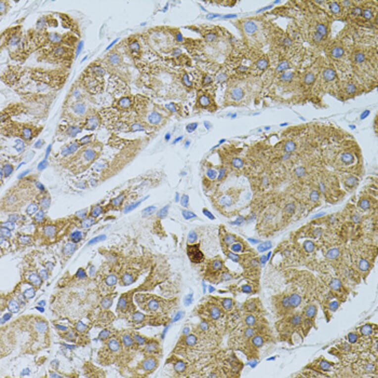 Immunohistochemistry - Anti-GNA13 Antibody (A5746) - Antibodies.com