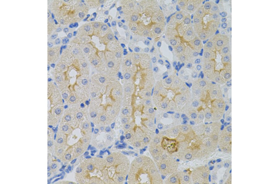 Immunohistochemistry - Anti-GNA13 Antibody (A5746) - Antibodies.com