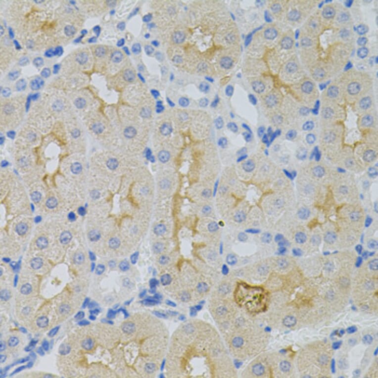 Immunohistochemistry - Anti-GNA13 Antibody (A5746) - Antibodies.com