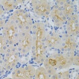 Immunohistochemistry - Anti-GNA13 Antibody (A5746) - Antibodies.com