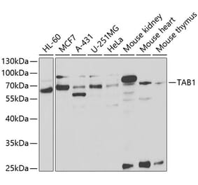 Western Blot - Anti-TAB1 Antibody (A14949) - Antibodies.com