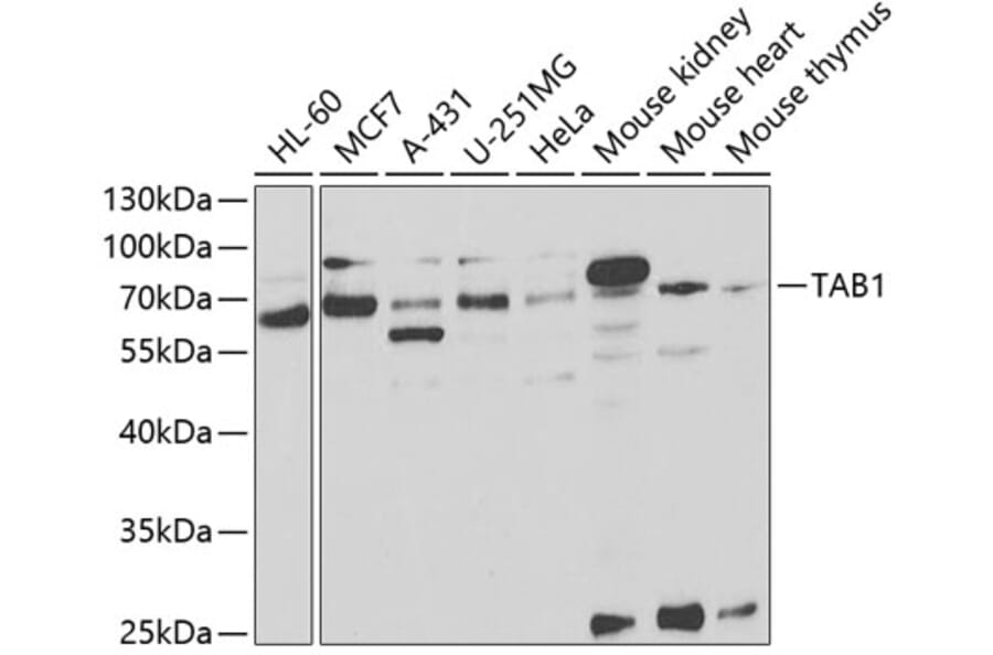 Western Blot - Anti-TAB1 Antibody (A14949) - Antibodies.com