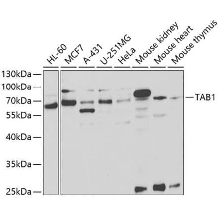 Western Blot - Anti-TAB1 Antibody (A14949) - Antibodies.com