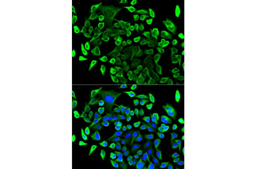 Immunofluorescence - Anti-TAB1 Antibody (A14949) - Antibodies.com