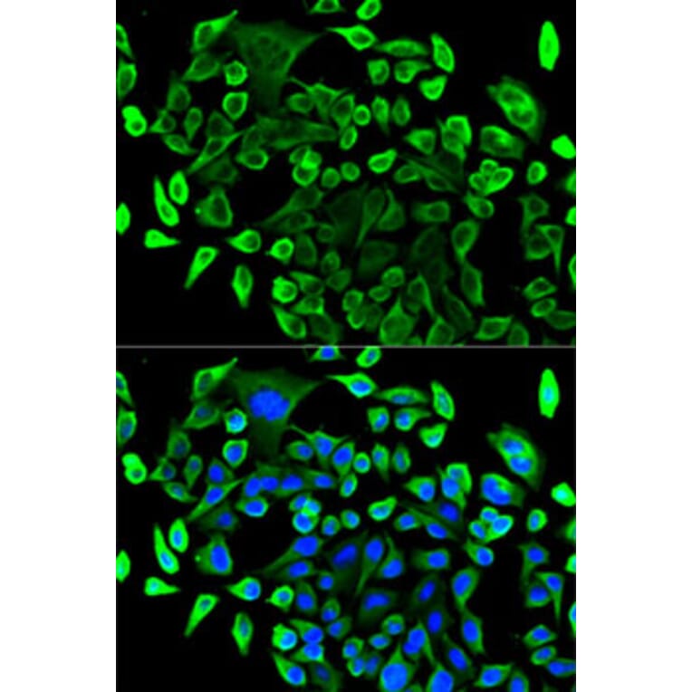 Immunofluorescence - Anti-TAB1 Antibody (A14949) - Antibodies.com