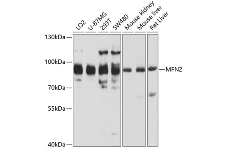 Western Blot - Anti-MFN2 Antibody (A5750) - Antibodies.com