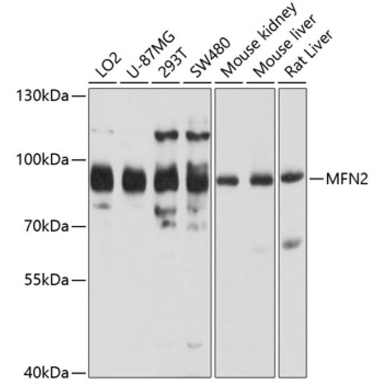 Western Blot - Anti-MFN2 Antibody (A5750) - Antibodies.com