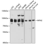Western Blot - Anti-MFN2 Antibody (A5750) - Antibodies.com
