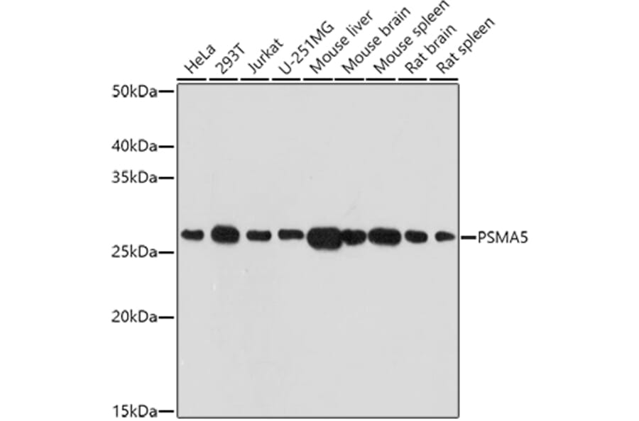 Western Blot - Anti-Proteasome 20S alpha 5/PSMA5 Antibody (A14951) - Antibodies.com