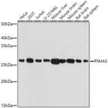 Western Blot - Anti-Proteasome 20S alpha 5/PSMA5 Antibody (A14951) - Antibodies.com
