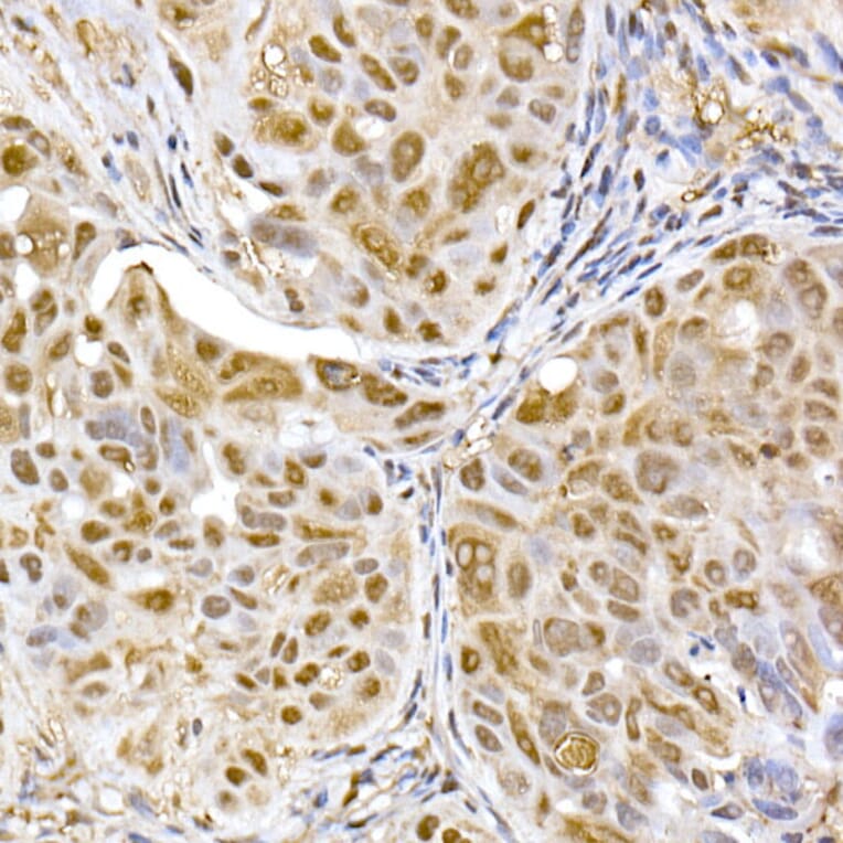 Immunohistochemistry - Anti-Proteasome 20S alpha 5/PSMA5 Antibody (A14951) - Antibodies.com