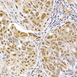 Immunohistochemistry - Anti-Proteasome 20S alpha 5/PSMA5 Antibody (A14951) - Antibodies.com