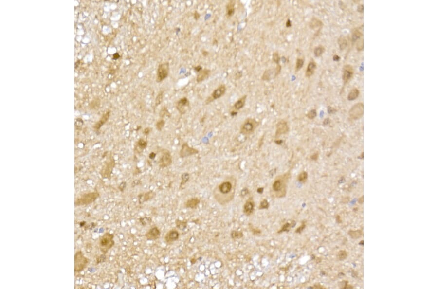 Immunohistochemistry - Anti-Proteasome 20S alpha 5/PSMA5 Antibody (A14951) - Antibodies.com
