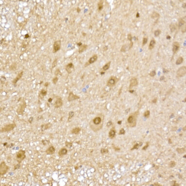 Immunohistochemistry - Anti-Proteasome 20S alpha 5/PSMA5 Antibody (A14951) - Antibodies.com