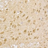 Immunohistochemistry - Anti-Proteasome 20S alpha 5/PSMA5 Antibody (A14951) - Antibodies.com